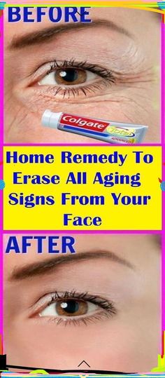 Home Remedy To Erase All Aging Signs From Your Face Motivational Fitness Quotes, Face Home, Motivational Fitness, The Beauty Department, Younger Looking Skin, Health Info, Look Younger, Fitness Quotes, Fall Hair