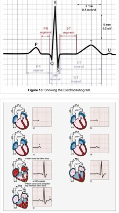 Cardiac Rhythms Cheat Sheets, Ekg Technician Aesthetic, Cardiac Technician, Stemi Ekg, 12 Lead Ekg Placement, Ekg Interpretation Made Easy, Cardiologist Doctor, Emt Study