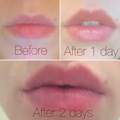 How To Make Your Lips Grow Bigger, How To Grow Your Lips Naturally, Lip Massage For Bigger Lips, How To Grow Lips, How To Get Bigger Lips, Bigger Lips Diy, Lip Plumper Diy, Lip Massage, Bigger Lips Naturally