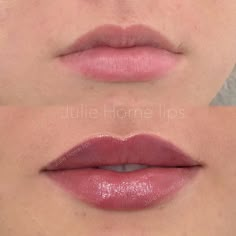 Restylane Lips, Mircoblading Eyebrows, Facial Contouring