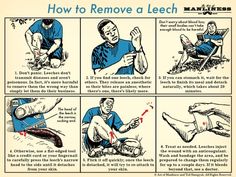 an instruction poster shows how to remove a leg from being injured by a man in blue shirt