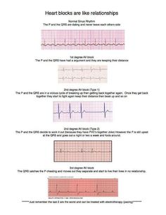 Ekg Interpretation, Ems Humor, Nursing Fun, Heart Blocks, Nursing Humor, Cardiac Nursing, Critical Care Nursing, Nursing Life, Nurse Rock