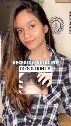 Women Receding Hairline Hairstyles, Receding Hairline Women Hairstyles, Haircuts For Receding Hairline Women, Receding Hairline Hairstyles Women, Bangs For Receding Hairline Women, Hairstyles For Receding Hairline Women, Bob Haircut With Undercut, Receding Hairline Women, Braids Without Extensions