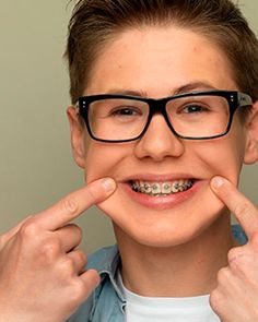 Braces For Kids, Jamil Viper, Misaligned Teeth, Kids Braces, Braces Tips, Sedation Dentistry, Dental Facts