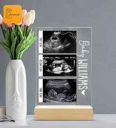 a vase with tulips in it next to an x - ray image on a table