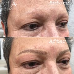 😍 What a beautiful transformation! Brows by Lindsey👸🏻More work by our Master Artists here -- https://buff.ly/2gKiMNR?utm_content=buffer1195e&utm_medium=social&utm_source=pinterest.com&utm_campaign=buffer #microblading #pmu Image Gallery