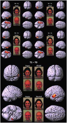 many different pictures of the human brain