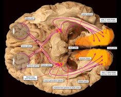 an image of the inside of a human brain