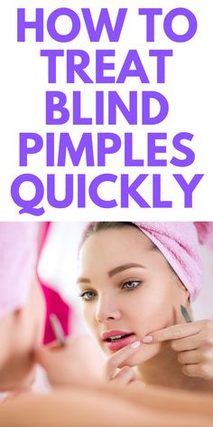 How to Get Rid of Blind Pimples - Blind Pimples can be painful for anyone. Here's how you simply treat them for you and your kids. Blind Pimple Remedies, Fitness Inspiration