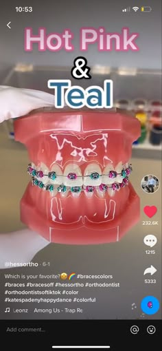 Cotton Candy Braces, Braces Color Combo Ideas, 2 Braces Colors Ideas, Neon Braces Colors, Cute Braces Colors Combinations, Braces Combination Colors, Teal And Pink Braces, August Braces Colors, Pink And Blue Braces