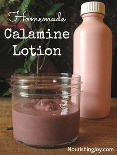 Homemade Calamine Lotion, Calamine Lotion, Healing Salves, Homemade Lotion, Diy Remedies, Homemade Remedies, Natural Health Remedies, Natural Home Remedies