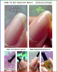 dition and nourish your nails with the super-sized Bye Brittle Nails! treat Long Strong Nails, Natural Nail Strengthener, Healthy Natural Nails, Broken Nails, Happy Nails, Brittle Nails, Nail Strengthener, Acrylic Gel, Strong Nails