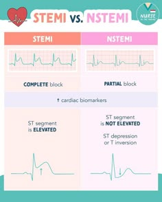 the differences between stemi and nstemi are shown in two separate screens, one with