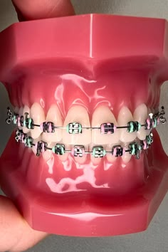 Braces Colors Combinations Summer, Pink And Green Braces, Green Braces Color, Braces Colors For Blondes, Braces Band Colors, Mint Green Braces, Summer Braces Colors, Light Pink Braces