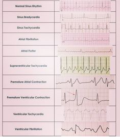 Nursing School Life, Nurse Skills, Medical School Life