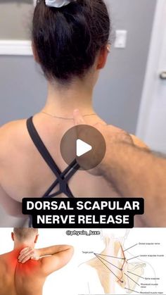 the back of a woman's neck and shoulder, with text that reads dorsal scapular nerve release