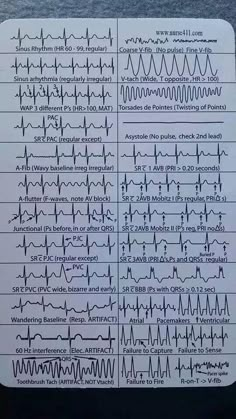 Paramedic School, Nursing Cheat, Nursing Student Tips, Cardiac Nursing, Medical Student Study, Pa School, Critical Care Nursing, Nursing School Survival