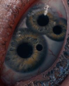 an image of the inside of someone's eye