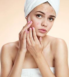 Acne is the most annoying skin condition that affects almost all the teenagers. There are different types of acne. Know how these various types of acne can be identified To Remove Pimples, Pimple Remover, Remove Pimples, Skin Care For Acne, Blackhead Remedies, Prevent Pimples