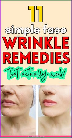 Ready to say goodbye to fine lines? These 11 diy wrinkles remedies will help you prevent wrinkles and keep your skin looking fresh! From home remedies for wrinkles to oils and massages, we’ve got all the wrinkle remedies face tricks you need. Check out the blog for the best anti aging tips and maintain your wrinkles skin care routine effortlessly! What Helps Wrinkles On Face, Coconut Oil And Baking Soda For Wrinkles, Remedies For Wrinkles On Face, Makeup With Wrinkles, Fine Line Remedies, Younger Skin Anti Aging, All Natural Wrinkle Remedies, How To Reduce Neck Wrinkles, Natural Botox For Face Wrinkles