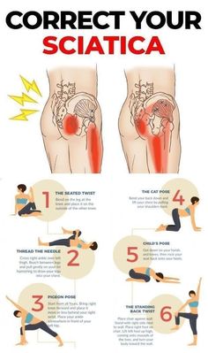 a poster showing how to correct your sciatica and the proper exercises you can do