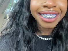 Braces blue now Braces Colors On Black Women, Blue Braces Aesthetic, Blue Power Chain Braces, Periwinkle Braces, Baby Blue Braces, Color Of Braces, Royal Blue Braces, Braces Black Women