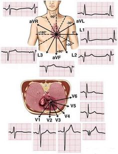 the diagram shows different types of heart valves and their corresponding heartbeats, along with an image of a man's chest