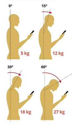 Forward Head Posture Exercises, Neck And Shoulder Muscles, Forward Head Posture, Massage Therapy Techniques, Posture Exercises