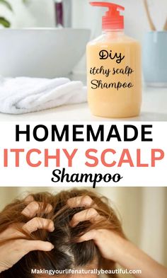 Itchy scalp can be caused due to many reasons like scalp dryness, pollution etc. Learn how to make shampoo for itchy scalp at home. Homemade natural shampoo recipe, home remedies for itchy scalp. Diy soap recipes. Remedies For Itchy Scalp, Soap Recipes Melt And Pour, Itchy Scalp Shampoo, Make Shampoo, Itchy Scalp Remedy, Fleas Home Remedies, Scalp Remedies, Dry Scalp Remedy, Homemade Shampoo Recipes