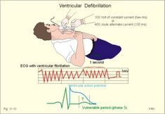 New Human Physiology Ch 11 Nursing Concepts, Ekg Technician