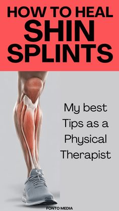 shin splints, tibia fracture, stress fracture, exercice, physical therapy Chin Splints Remedy, Shin Stretches, Shin Splint Relief, Posture Tips