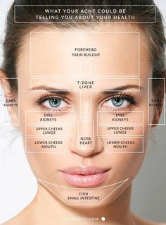 Gesicht Mapping, Doterra Acne, Face Mapping Acne, Face Mapping, Acne Causes, Oil Pulling, Face Acne, Body Organs, How To Get Rid Of Acne