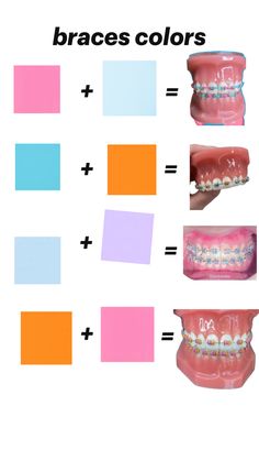 inspirational Best Braces Colors, Brace Ideas, Braces Colors Ideas