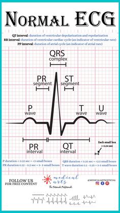 Normal ECG cheatsheet explains the mechanism of PQRST , helps calculate the durations of PQRST in seconds and in small boxes counts (blocks). Simplified version for easy reading. Ecg Reading, Normal Ecg, Cardiac Cycle, Human Heart Anatomy, Pr Interval, Basic Anatomy And Physiology, Medical Videos, Heart Anatomy