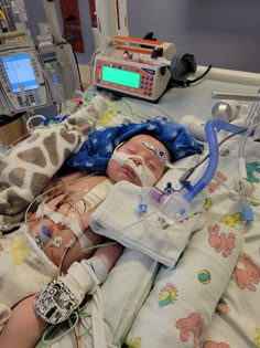 a baby in a hospital bed with an oxygen tube attached to it's head