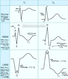 four diagrams showing different types of waveforms and their corresponding amplitudes, with the same number