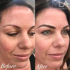 Holy COMBO brows! 🔥 Using the technique of microblading + shading, we are able to create a bold and defined brow that holds up all year long 👑 #microblading #shading #pmu #combobrows #browsonpoint Micro Blading, Makeup Eyebrows, Eyebrow Makeup Tips, Permanent Makeup Eyebrows, Eye Brows, Perfect Eyebrows, Microblading Eyebrows