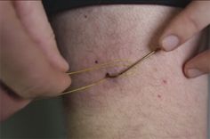 Video Pro Tip: How to Remove a Fish Hook from Your Skin - Orvis News Fly Fishing Tips, Fly Fisherman, Fishing Stuff, Hunting And Fishing, Fly Rods, Fish Camp, Saltwater Fishing