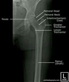 an x - ray shows the bones and their major structures, including the feromal neck