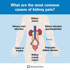 Kidney pain is felt in your sides, back, belly or groin. It’s often mistaken for back pain. Kidney pain can be caused by kidney stones, kidney infection, an injury or kidney cancer. Kidney pain treatment depends on the underlying cause. Kidney Pain, Test Results, Urinary Tract, Medical Illustration, Blood Test