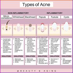 Remember those teen years when acne felt like the end of the world? 🙈 Then we hit our 20s, and just as our skin finally cleared up, life threw us a curveball—adult acne. Fast forward to our 40s, and guess who’s back? Yep, those pesky breakouts have returned, and this time, they’ve brought their friend: menopause 🤦‍♀️. Turns out, puberty and perimenopause have a lot in common—they both love to mess with our hormones and our skin. 🤷‍♀️ So here we are, battling breakouts in our 40s. But hey, at... Skincare Over 40, Different Types Of Acne, Clear Skin Routine, Best Facial Cleanser, Slice Of Pizza