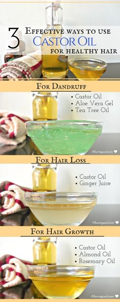 Castor Oil Hair Mask is great for all your hair woes as it has all the essential nutrients which promote hair growth and treat dandruff and also prevents from hair fall. To get the fabulous benefits of castor oil, all your need is to follow these recipes. Hair Mask For Dandruff, Oil For Healthy Hair, Castor Oil For Hair