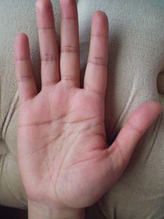 Heart Line Palmistry, Family Issue, Indian Palmistry, Palmistry Reading, Yoga Information, Separation And Divorce, Heart Line, Broken Lines, Sweaty Hands