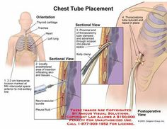 the chest and shoulder are labeled in this diagram