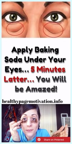 Apply Baking Soda Under Your Eyes…5 Minutes Latter…You Will be Amazed! Wrinkles Remedies, Baking Soda Face, Baking Soda Benefits, Remove Dark Circles, Skin Care Wrinkles, Baking Soda Uses, Baking Soda Shampoo, Dark Circles Under Eyes, Under Eye Bags