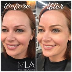 🔥 Look at these beauties by Master Artist Emily Harginger (brows here--https://buff.ly/2whXaPP?utm_content=buffer9b600&utm_medium=social&utm_source=pinterest.com&utm_campaign=buffer her beautiful client 🌺  #microblading #pmu Angeles, Look At