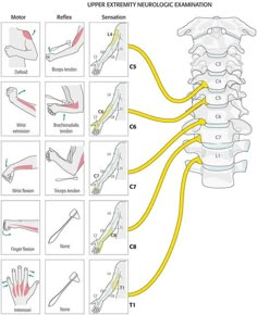 Medical Diagrams, Sistem Saraf, Bolesti Chrbta, Medical School Studying