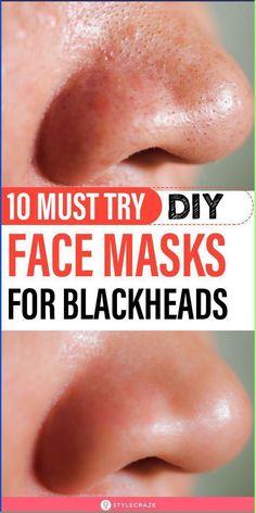 10 Must Try DIY Face Masks For Blackheads : Blackheads are a mild form of acne.They are formed when your skin pores are clogged due to the oversecretion of oil and sebum. If you don’t know where to begin, we have a list of DIY blackhead removal mask recipes for you. Take a look! #skincare #beauty #blackheads #acne #skinacne #diy #facemasks Blackhead Removal Mask, Face Masks For Blackheads, Masks For Blackheads, Removing Blackheads, Face Mask For Blackheads, Black Head Remover Mask, Blackhead Mask, Mask Recipes, For Blackheads