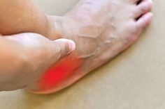 Swollen Ankles, Ankle Injury, Health Heal, Sprained Ankle, Heel Pain, Foot Pain