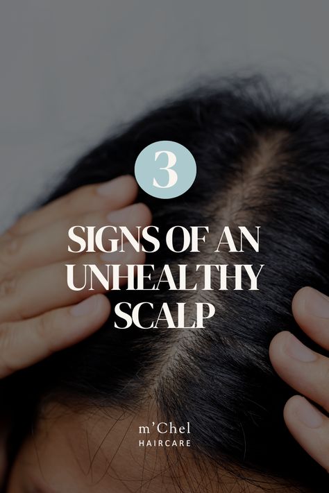 Healthy, luscious hair begins with a well-maintained scalp. Often overlooked, scalp health significantly impacts the appearance and vitality of your locks. Issues like itchiness and excessive oiliness can signal scalp problems. In this blog post, we'll discuss three signs of an unhealthy scalp and provide three solutions to restore balance. Plus, we'll explain why replacing aerosol dry shampoo with 'The Day After Brush', our 2-in-1 powder dry shampoo is a game-changer for scalp and hair health. Scalp Health Tips, Unhealthy Scalp, Powder Dry Shampoo, Unhealthy Hair, Dry Flaky Scalp, Shampoo For Dry Scalp, Scalp Problems, Scalp Brushing, Flaky Scalp